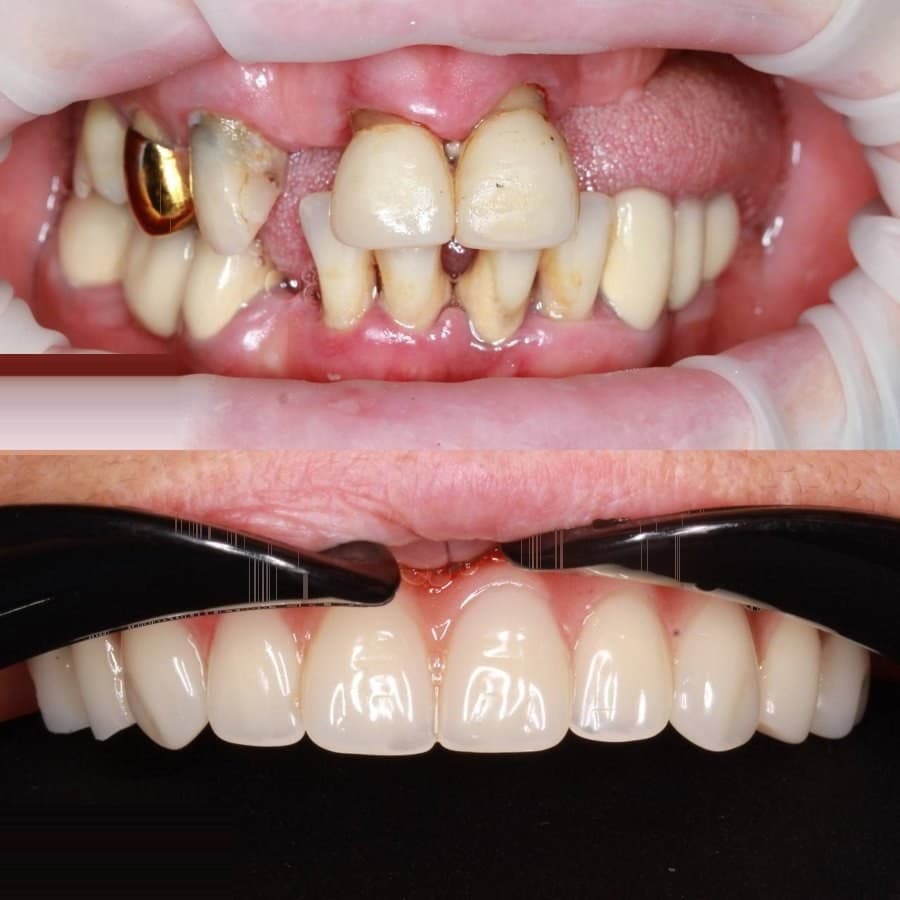Orthodontics: before and after at Dentor